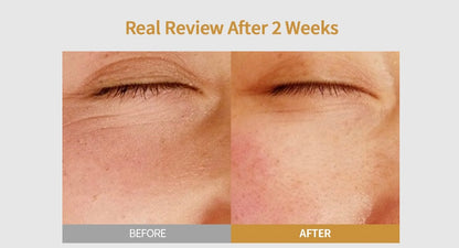 DermaBloom™ -Editor Collagen Plumping Essence