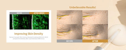 DermaBloom™ -Editor Collagen Plumping Essence