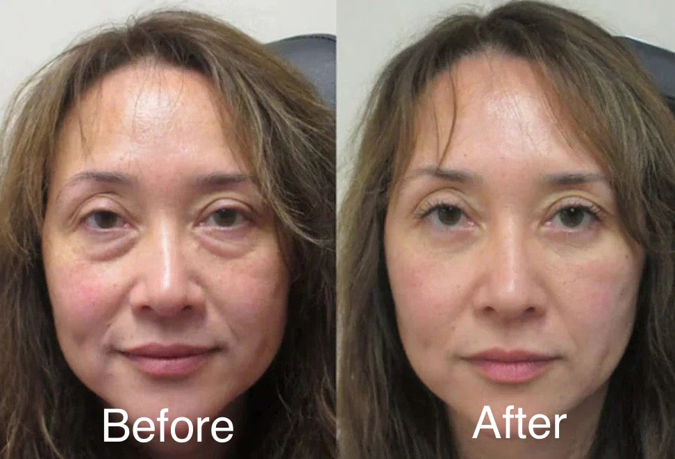 DermaBloom™ -Editor Collagen Plumping Essence